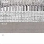 Garden Rocking Armchair Solid och klädda tyg - Smart av Varaschin Viadurini