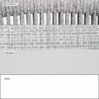 Garden Rocking Armchair Solid och klädda tyg - Smart av Varaschin Viadurini