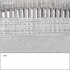 Garden Lounge fåtölj klädd tyg och aluminium - Smart av Varaschin Viadurini